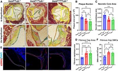 Neutrophil-specific STAT4 deficiency attenuates atherosclerotic burden and improves plaque stability via reduction in neutrophil activation and recruitment into aortas of Ldlr−/− mice